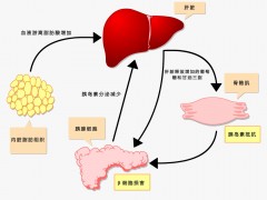 得了脂肪肝，要提防糖尿病