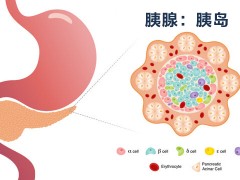 保护β细胞功能，预防糖尿病的关键