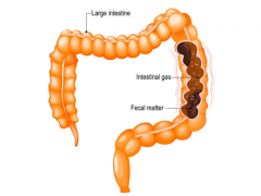 【症状】便秘Constipation