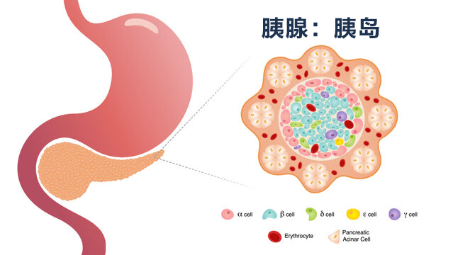 保护β细胞功能，预防糖尿病的关键